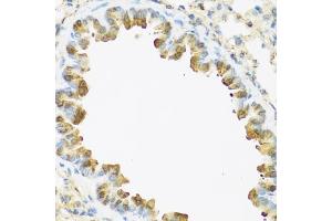 Immunohistochemistry of paraffin-embedded mouse lung using S100/Psoriasin antibody (ABIN3015738, ABIN3015739, ABIN3015740 and ABIN6219085) at dilution of 1:100 (40x lens). (S100A7 antibody  (AA 1-101))