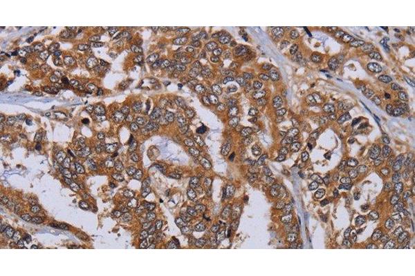 MFAP3L antibody