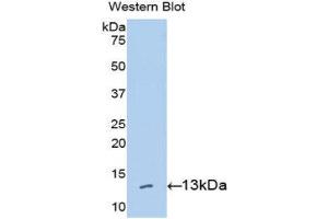 Western Blotting (WB) image for anti-High Mobility Group AT-Hook 1 (HMGA1) (AA 1-107) antibody (ABIN3205548) (HMGA1 antibody  (AA 1-107))