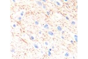 IHC-P analysis of Human Tissue, with DAB staining. (SLC6A3 antibody  (AA 562-620))