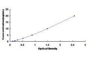 ELISA image for Sodium Channel, Nonvoltage-Gated 1, beta (SCNN1B) ELISA Kit (ABIN419026)