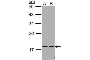 WB Image Sample (30 ug of whole cell lysate) A: H1299 B: Hela 12% SDS PAGE antibody diluted at 1:1000 (PCNP antibody  (N-Term))