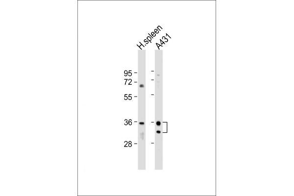 BIRC7 antibody  (C-Term)