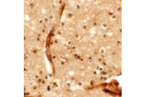 Immunohistochemical analysis of KCNK13 in human brain tissue with KCNK13 polyclonal antibody  at 5 ug/mL.
