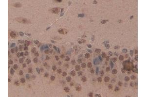 Immunohistochemistry (IHC) image for anti-CD2-Associated Protein (Cd2ap) (AA 368-623) antibody (ABIN7439519)