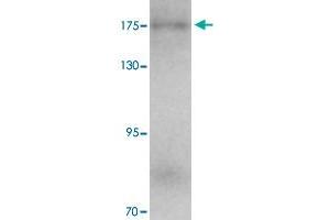 Western blot analysis of KIAA0196 in human ovary tissue with KIAA0196 polyclonal antibody  at 1 ug/mL.