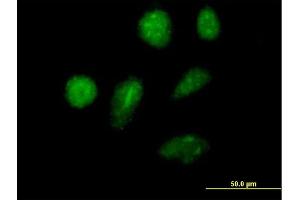 Immunofluorescence of purified MaxPab antibody to ZNFN1A2 on HeLa cell. (IKZF2 antibody  (AA 1-500))
