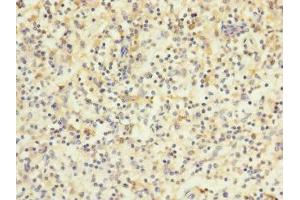 Immunohistochemistry of paraffin-embedded human spleen tissue using ABIN7175617 at dilution of 1:100 (HVCN1 antibody  (AA 1-100))