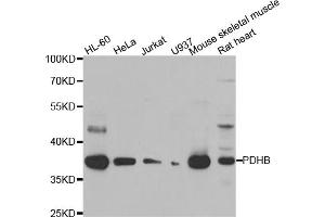 Western blot analysis of extracts of various cell lines, using PDHB antibody (ABIN5975451) at 1/1000 dilution. (PDHB antibody)