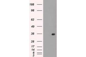Image no. 2 for anti-Fc gamma RII (CD32) antibody (ABIN1497255) (Fc gamma RII (CD32) antibody)