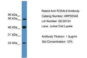 WB Suggested Anti-TCEAL6  Antibody Titration: 0. (TCEAL6 antibody  (C-Term))