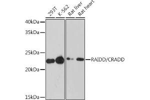 Western blot analysis of extracts of various cell lines, using RAIDD/CRADD Rabbit mAb (ABIN7266107) at 1:1000 dilution.