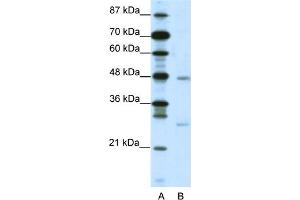 WB Suggested Anti-MXD4 Antibody   Titration: 2.