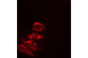 ABIN6274823 staining COLO205 cells by IF/ICC. (AKR1A1 antibody  (C-Term))