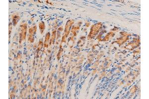 ABIN6267067 at 1/100 staining mouse gastric tissue sections by IHC-P. (TGFB1 antibody  (C-Term))