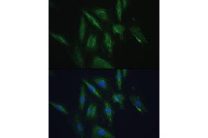 Immunofluorescence analysis of H9C2 cells using SRPRB antibody (ABIN6132685, ABIN6148459, ABIN6148460 and ABIN6214895) at dilution of 1:100. (SRPRB antibody  (AA 57-271))