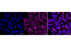 Immunocytochemical staining of HepG2 cells with phospho-GATA3 (S308) antibody (ABIN7798696), 1:1,000). (Recombinant GATA3 antibody  (pSer308))