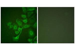 Immunofluorescence analysis of A549 cells, using TIMP2 antibody (ABIN5976522). (TIMP2 antibody  (Internal Region))