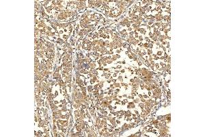 IHC analysis of Citrin/SLC25A13 using anti-Citrin/SLC25A13 antibody (ABIN7599512). (slc25a13 antibody  (AA 1-643))