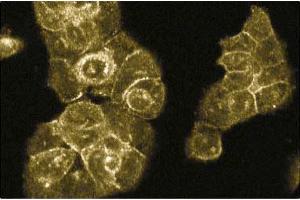 Immunofluorescence staining of A431 cells. (RABEP1 antibody  (AA 247-417))