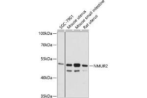 Western blot analysis of extracts of various cell lines, using NMUR2 antibody (ABIN6128345, ABIN6144693, ABIN6144694 and ABIN6216572) at 1:3000 dilution. (NMUR2 antibody  (AA 326-415))