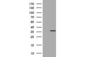 HEK293T cells were transfected with the pCMV6-ENTRY control (Left lane) or pCMV6-ENTRY CAPZA1 (Right lane) cDNA for 48 hrs and lysed. (CAPZA1 antibody)