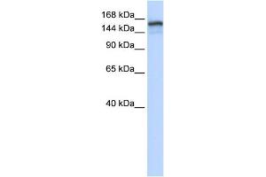 WB Suggested Anti-NFKBIL2 Antibody Titration:  0.
