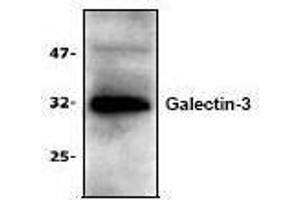 Image no. 1 for anti-Galectin 3 (LGALS3) antibody (ABIN127220) (Galectin 3 antibody)