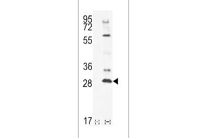 Western blot analysis of TSSK4 using rabbit polyclonal TSSK4 Antibody using 293 cell lysates (2 ug/lane) either nontransfected (Lane 1) or transiently transfected (Lane 2) with the TSSK4 gene. (TSSK4 antibody  (C-Term))