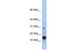 HIST2H2BF antibody used at 1 ug/ml to detect target protein. (HIST2H2BF antibody  (N-Term))