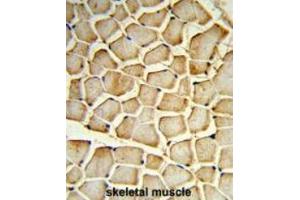 Formalin-fixed and paraffin-embedded human skeletal muscle reacted with PIK4CB Antibody (Center), which was peroxidase-conjugated to the secondary antibody, followed by DAB staining. (PI4KB antibody  (Middle Region))