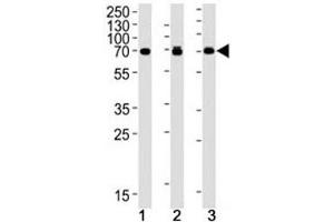 S6K2 antibody western blot analysis in human (1) Jurkat, (2) MCF-7 and (3) mouse NIH3T3 cell lysate. (RPS6KB2 antibody)