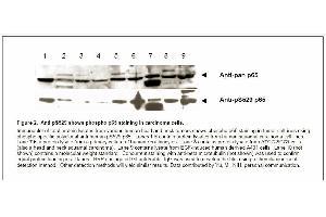 Image no. 2 for anti-Nuclear Factor-kB p65 (NFkBP65) (pSer529) antibody (ABIN116929) (NF-kB p65 antibody  (pSer529))
