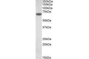 Western Blotting (WB) image for anti-Protein Disulfide Isomerase Family A, Member 2 (PDIA2) (AA 477-489) antibody (ABIN1491836) (PDIA2 antibody  (AA 477-489))
