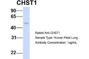 Host: Rabbit Target Name: CHST1 Sample Type: Human Fetal Lung Antibody Dilution: 1. (CHST1 antibody  (Middle Region))