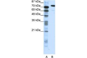 WB Suggested Anti-SATB1 Antibody Titration:  1. (SATB1 antibody  (C-Term))
