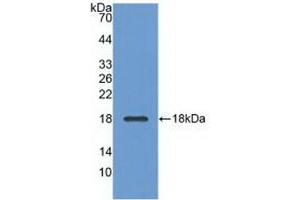 Detection of Recombinant ADP, Bovine using Polyclonal Antibody to Adiponectin (ADPN) (ADIPOQ antibody  (AA 103-240))