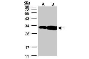 WB Image Sample(30 μg of whole cell lysate) A:Hep G2, B:MOLT4, 12% SDS PAGE antibody diluted at 1:500 (HOXC11 antibody)