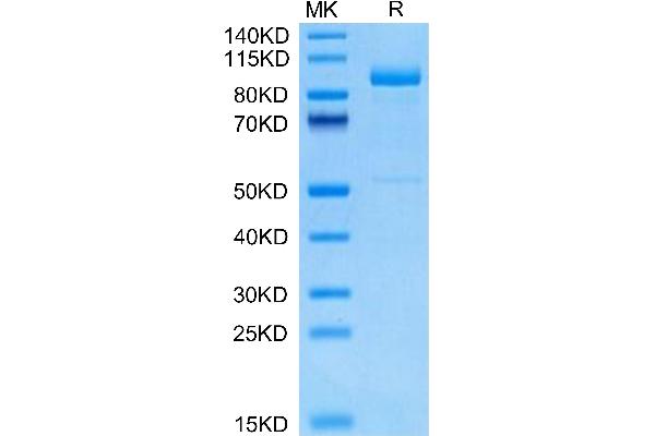 Lrig1 Protein (AA 34-792) (His tag)