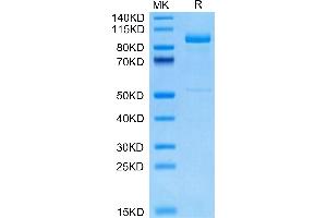 Cynomolgus LRIG1 on Tris-Bis PAGE under reduced condition. (Lrig1 Protein (AA 34-792) (His tag))