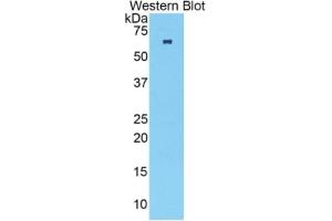 TNNC2 ELISA Kit