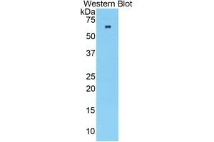 WB of Protein Standard: different control antibodies  against Highly purified E. (TNNC2 ELISA Kit)