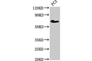 Western Blot Positive WB detected in: PC-3 whole cell lysate All lanes: ICK antibody at 3 μg/mL Secondary Goat polyclonal to rabbit IgG at 1/50000 dilution Predicted band size: 72, 35 kDa Observed band size: 72 kDa (ICK antibody  (AA 150-275))