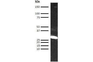 Western Blotting (WB) image for anti-alpha 1 Microglobulin/bikunin precursor (AMBP) antibody (Biotin) (ABIN613255) (AMBP antibody  (Biotin))
