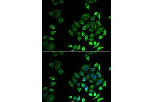 Immunofluorescence analysis of U2OS cells using PLA2G2D antibody (ABIN5974308). (PLA2G2D antibody)