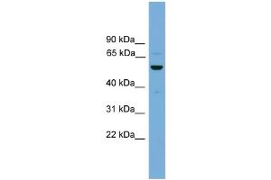 WB Suggested Anti-ASZ1 Antibody Titration: 1. (ASZ1 antibody  (Middle Region))