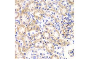 Immunohistochemistry of paraffin-embedded rat kidney using SHMT2 Antibody. (SHMT2 antibody  (AA 265-504))