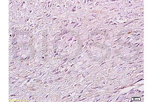 FIP200 antibody  (AA 501-600)