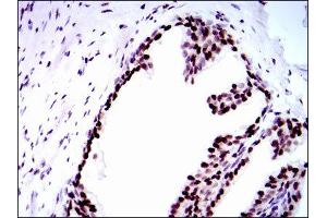 Immunohistochemistry (IHC) image for anti-Replication Protein A1, 70kDa (RPA1) antibody (ABIN1846411) (RPA1 antibody)