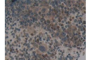 Immunohistochemistry (IHC) image for anti-Neutrophil Cytosolic Factor 4, 40kDa (NCF4) (AA 111-339) antibody (ABIN7442450)
